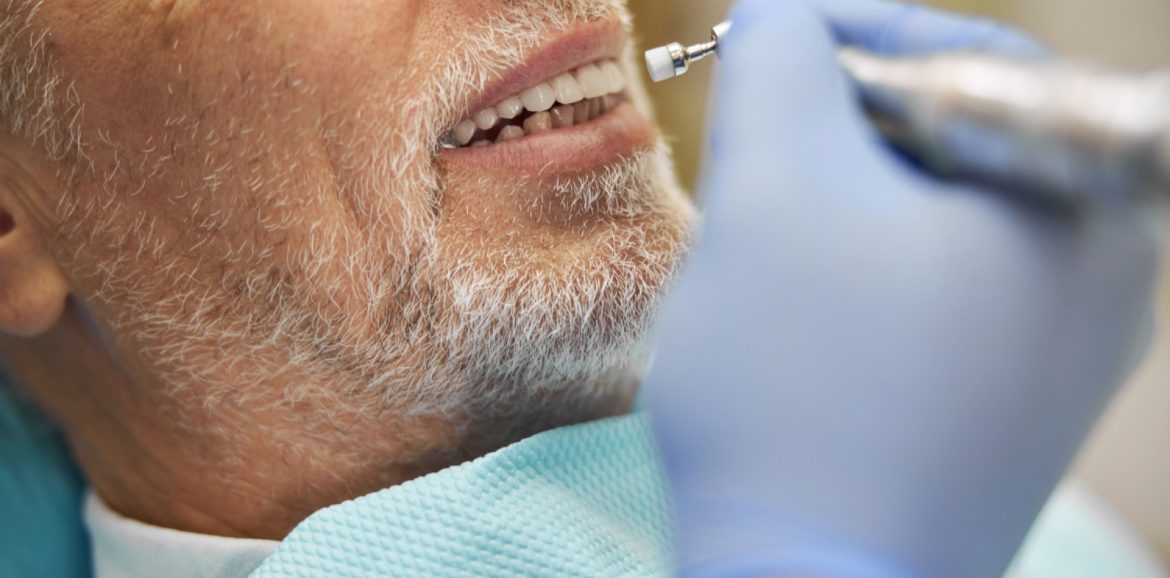 Pourquoi faire reprendre un implant dentaire défectueux ?