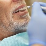 Pourquoi faire reprendre un implant dentaire défectueux ?