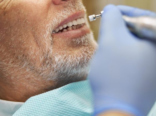 Pourquoi faire reprendre un implant dentaire défectueux ?